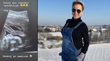 Martina Pártlová (41) omylem odtajnila pohlaví miminka! Fotka z ultrazvuku mluví za vše