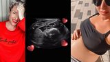 Těhotná Martina Pártlová se pochlubila snímkem z ultrazvuku: Už je jasné, po kom miminko bude!
