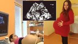Česká supermáma brzy porodí paterčata: Tohle je smímek z ultrazvuku!