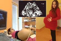 Česká supermáma brzy porodí paterčata: Tohle je smímek z ultrazvuku!