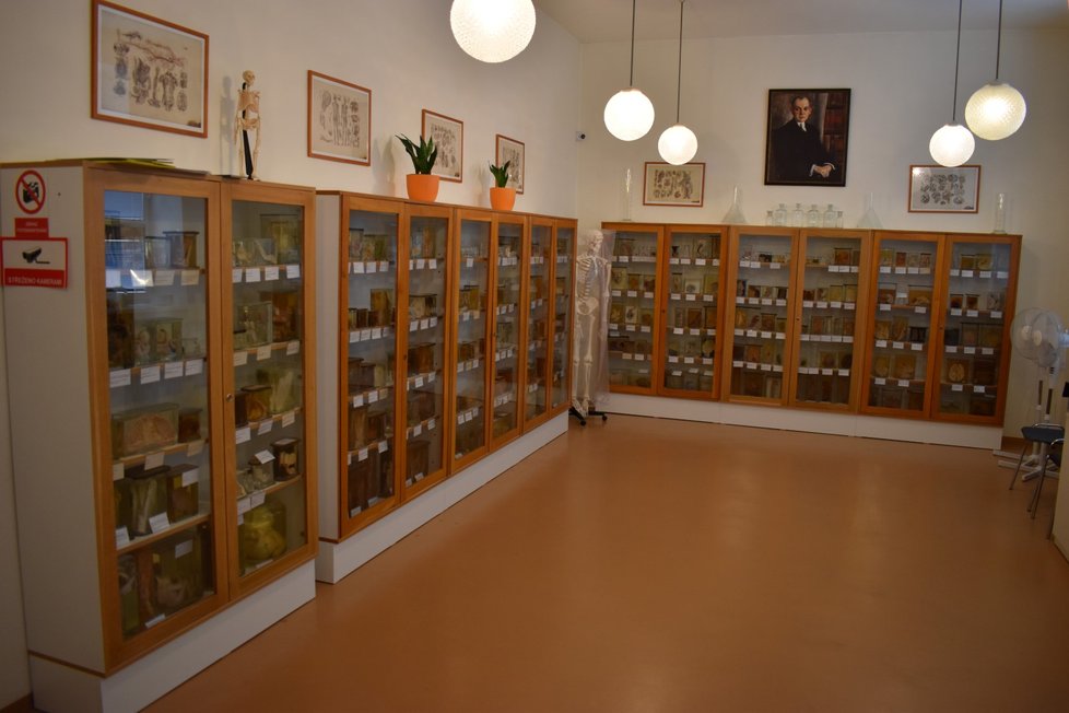Muzeum patologie v opavské Slezské nemocnici.