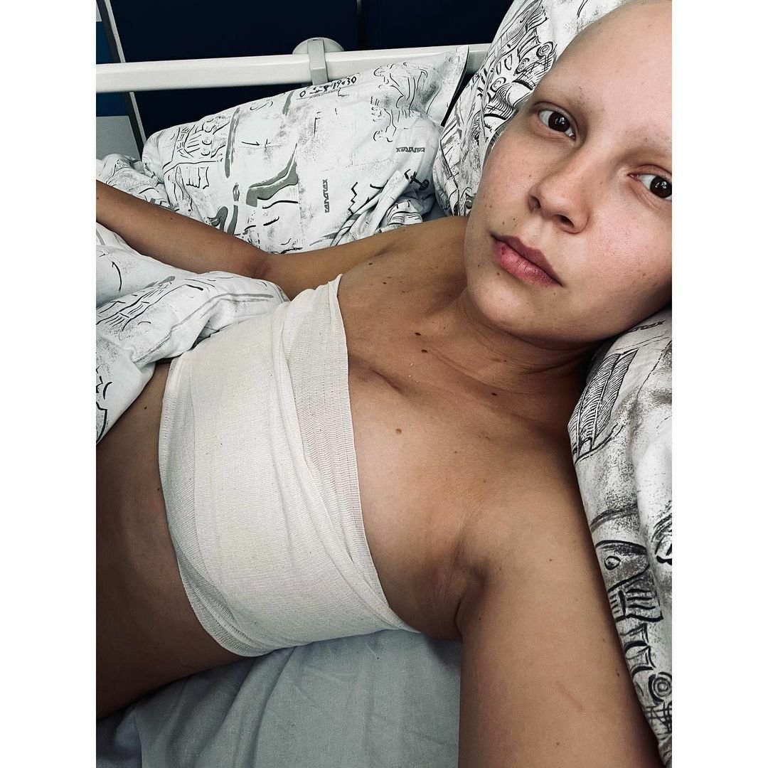 Patrícia Janečková podstoupila mastektomii