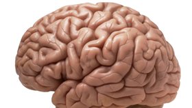 Takto vypadá mozek zdravého člověka. Na povrchu je zvrásněný do závitů.