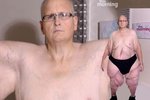Zoufalý Paul Mason pózuje nahý, aby získal peníze na odstranění přebytečné kůže.