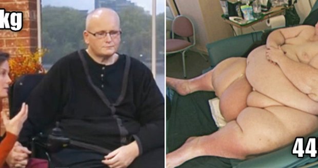 Bývalý nejtěžší muž světa našel lásku přes Facebook: Chce mu zaplatit odstranění 50 kg kůže!