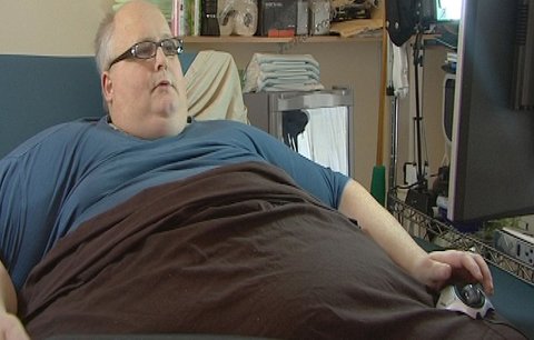 Nejtlustší člověk světa: Po operaci zhubl 126 kilo!