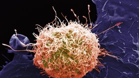 Rakovinová buňka