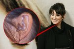 Penélope Cruz věří alternativní medicíně