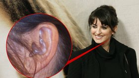 Penélope Cruz věří alternativní medicíně