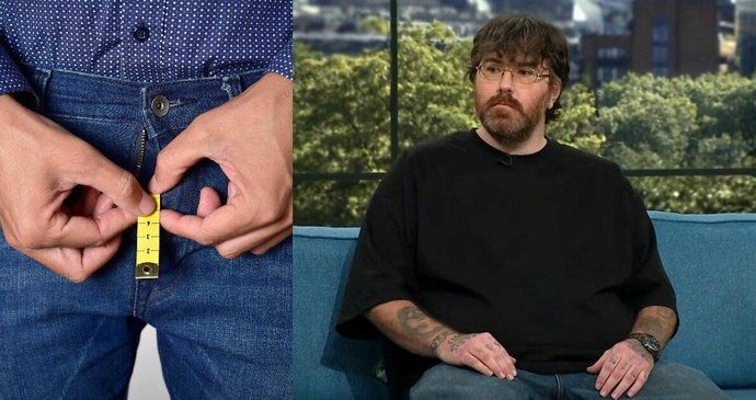 Michael Phillips tvrdí, že ná "nejmenší penis na světě", má diagnostikovaný mikropenis.