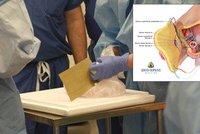VIDEO unikátní operace: Muži transplantovali penis! Na sál ho přinesli v pytlíku