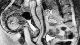Další prvenství. První reálný snímek „anatomie“ pohlavního styku. Mužský orgán je na něm zakroucený do tvaru bumerangu.