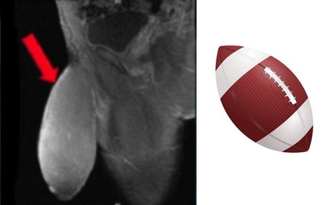 Američanův penis byl sice menší než ragbyový míč...ale tvarem ho připomínal.