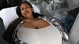 Peruánce vyrostla gigantická prsa velikosti N!