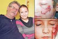 Před 10 lety jí pes vykousl kus tváře: Jizva zůstala, viník není