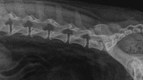Na rentgenu je vidět močový měchýř plný močových kamenů.