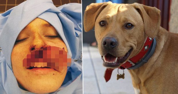 Pes z útulku zaútočil na svou paničku: Roztrhal jí obličej!