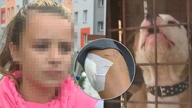 Nikolku (11) pokousal nebezpečný pes: Dívka skončila v nemocnici! Majitelce psa hrozí rok vězení