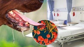 Žena podstoupila vícečetné amputace poté, co se nakazila infekcí ze psích slin