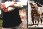 Agresivní pes (ilustrační foto) rozsápal majiteli ruce.