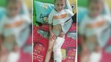 Péťu srazilo před školou auto: Prvňáček má zlomenou ruku i nohu