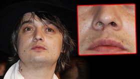 Pete Doherty přijel do Cannes s nosem odřeným od šňupání kokainu