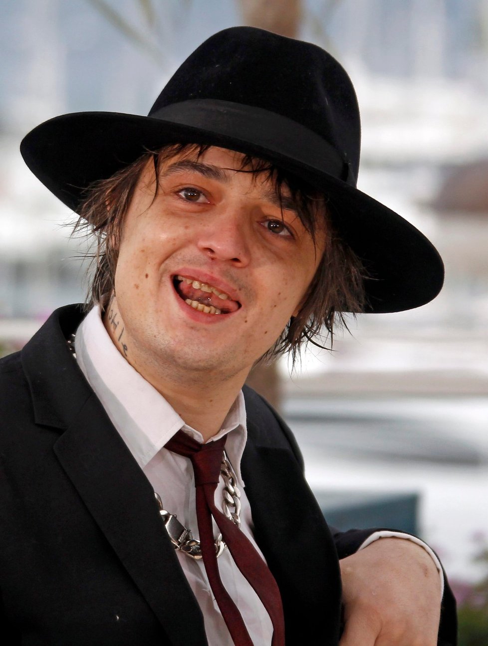 Pete Doherty a jeho drogami zničená tvář a zuby