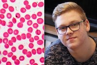 Petr (16) trpí hemofilií: Stres z pandemie nemoc zhoršuje, pacienti mohou snáz krvácet