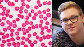 Petr (16) trpí hemofilií, vzácnou nemocí, která se projevuje poruchou srážlivosti krve
