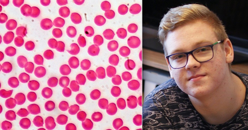 Petr (16) trpí hemofilií, vzácnou nemocí, která se projevuje poruchou srážlivosti krve