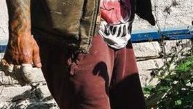 Snowboardista David Horváth odhalil fotkou, že si při pádu helikoptéry vážně poranil ruku. I tři měsíce od neštěstí má zafačované prsty.
