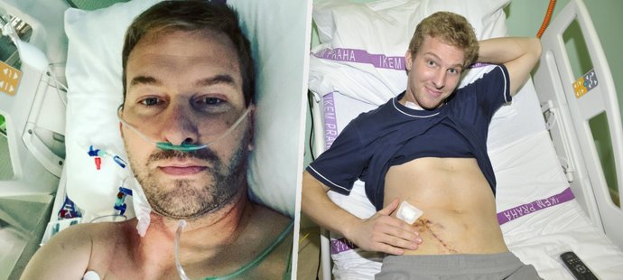 Bývalý fotbalista Petr Mikolanda má za sebou druhou transplantaci ledviny.