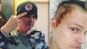 Expartner Rolinsové a Průšové Petr Vlasák má agresivní nádor v hlavě: Sedm chemoterapií nepomohlo