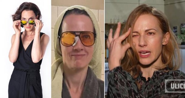 Petru Bučkovou potrápilo ječné zrno v oku