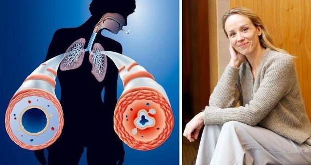 Petra Hřebíčková trpí vážnou nemocí.