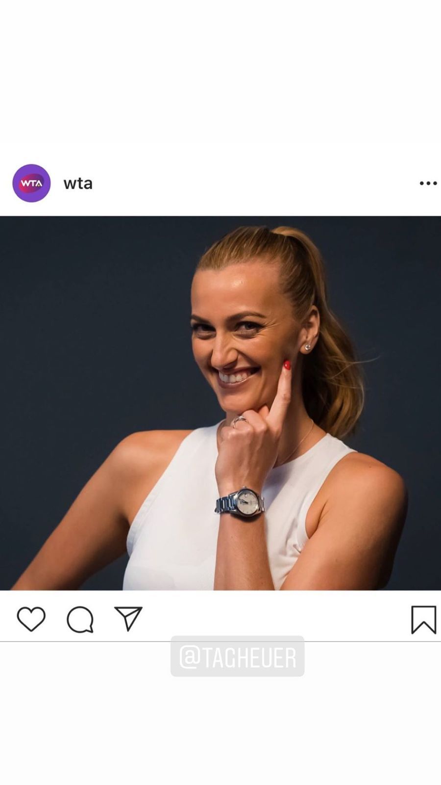 Petra Kvitová musí na zápasy prozatím zapomenout, a tak je z ní dočasně modelka!