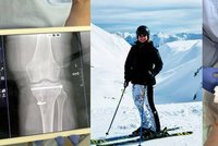 Hejtmanka Pecková je po operaci: Ošklivý úraz při lyžování v rakouských Alpách!