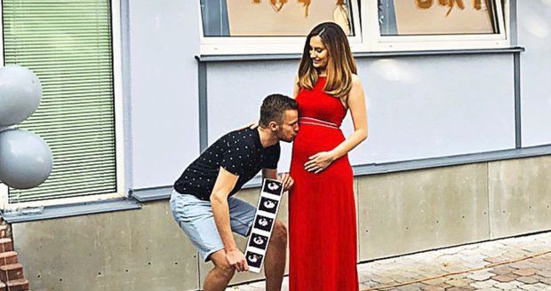 Misska Petra Sliacká přišla o své miminko tři týdny před porodem.