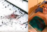 Chlapce (11) připravil vlak o obě nohy: Kamarádi ho nechali umírat a utekli