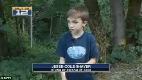 Jesse-Cole (8), kterého zachránila jeho fenka před rozzuřenými včelami.