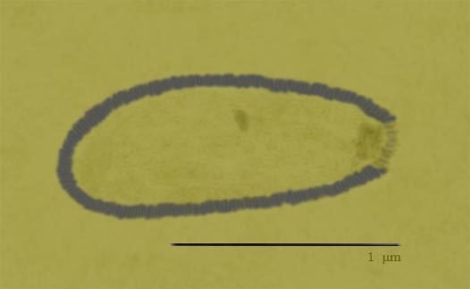30 tisíc let starý Pithovirus sibericum je největší známý virus. Měří 1500 nm