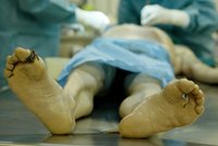 Koronavirus způsobil muži (†69) tříhodinovou erekci: Pacient po dlouhém utrpení podlehl