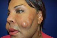 Oběť falešného plastického chirurga: Podívejte se, jak ji vylepšil!