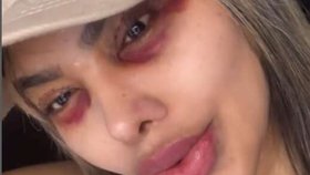 Tatiana žije v bolestech.