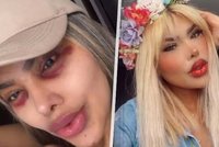 Tatianu šikanovali kvůli vzhledu: Proměnila se v Barbie a žije v bolestech