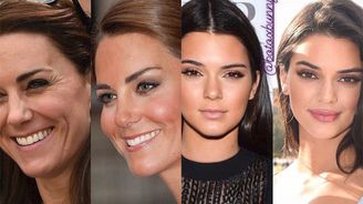 Instagram odhaluje plastiky slavných: Od Kendall Jenner po vévodkyni Kate!