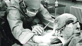 Plastičtí chirurgové v nemocnici na Vinohradech dokázali zázrak!