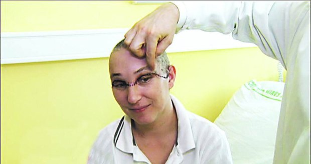 Vrtačka jí skalpovala hlavu: Plastický chirurg dokázal zázrak!