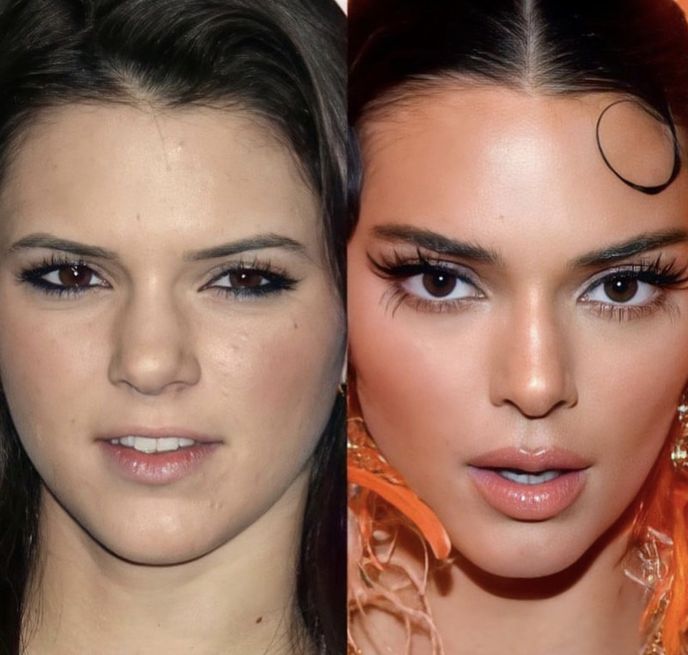 Jak je vidět, oslnivá krása Kendall Jenner stála hodně peněz. 