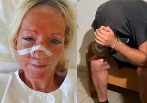 Ukrajinka Lilia skončila po napadení v nemocnici se zlomeninami v obličeji. Policie nyní navrhla obžalovat útočníka (48). Hrozí mu až pět let vězení.